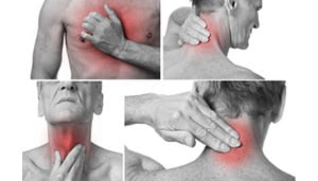 CRPS chronic regional pain syndrome