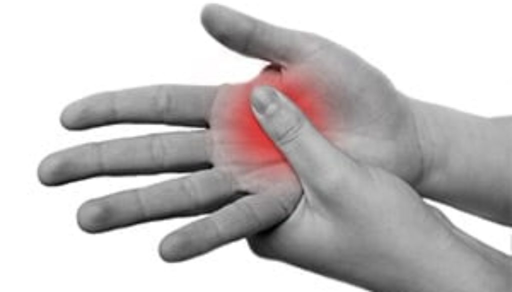 Rheumatoid arthritis